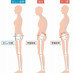 骨盤と姿勢の深い関係 ― 腰痛・肩こり・疲労感の隠れた原因とは？